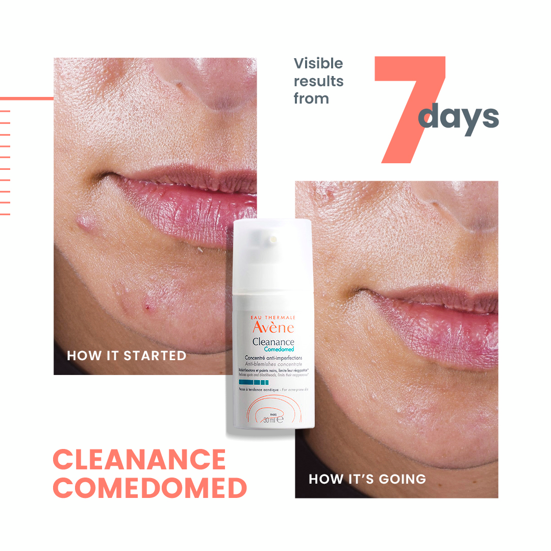Avène Cleanance Comedomed Anti-Blemish treatment, 30ml